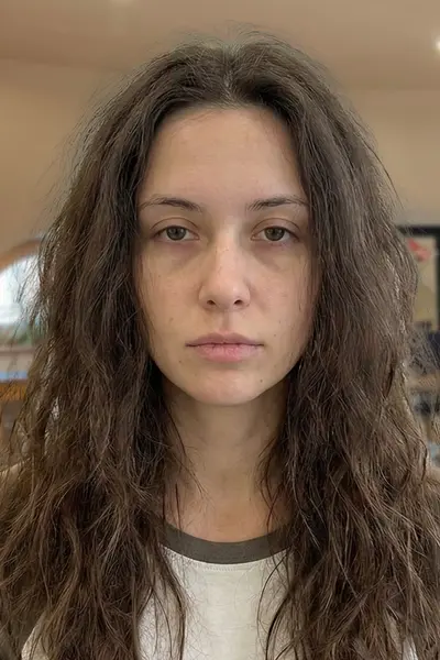 Before after saska before